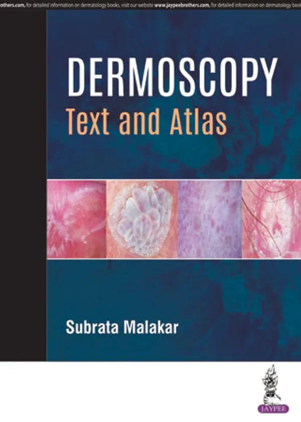 Dermoscopy_Text_And_Atlas