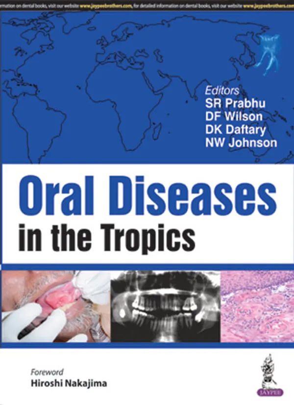 Oral_Diseases_In_The_Tropics