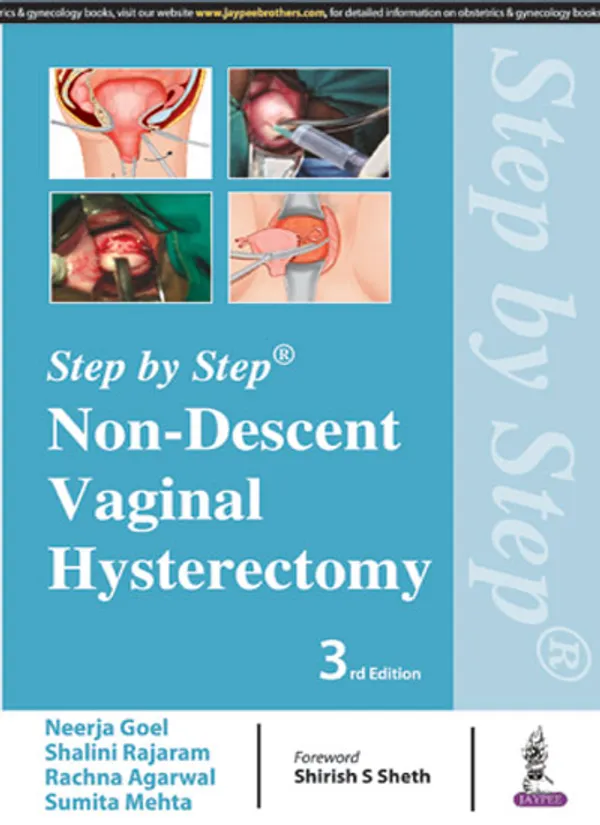 Step_By_Step_Non_Descent_Vaginal_Hysterectomy