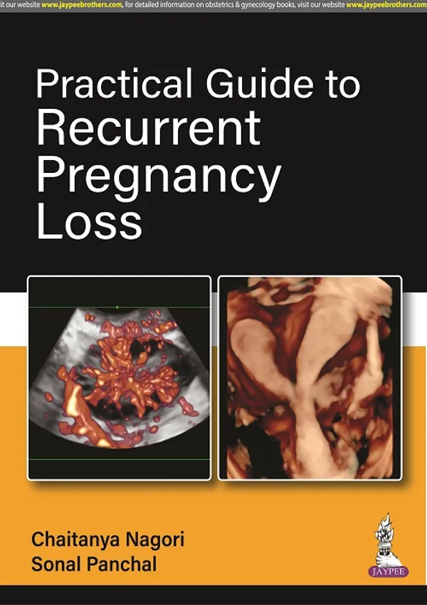 Practical_Guide_To_Recurrent_Pregnancy_Loss