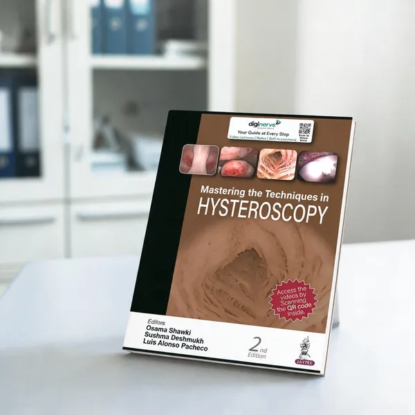 Mastering_The_Techniques_In_Hysteroscopy