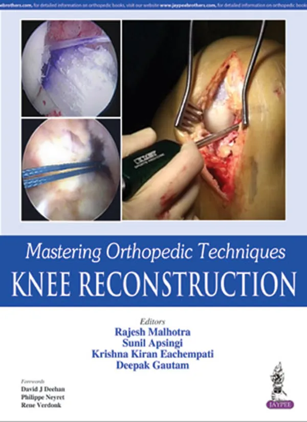 Mastering_Orthopedic_Techniques_Knee_Reconstruction