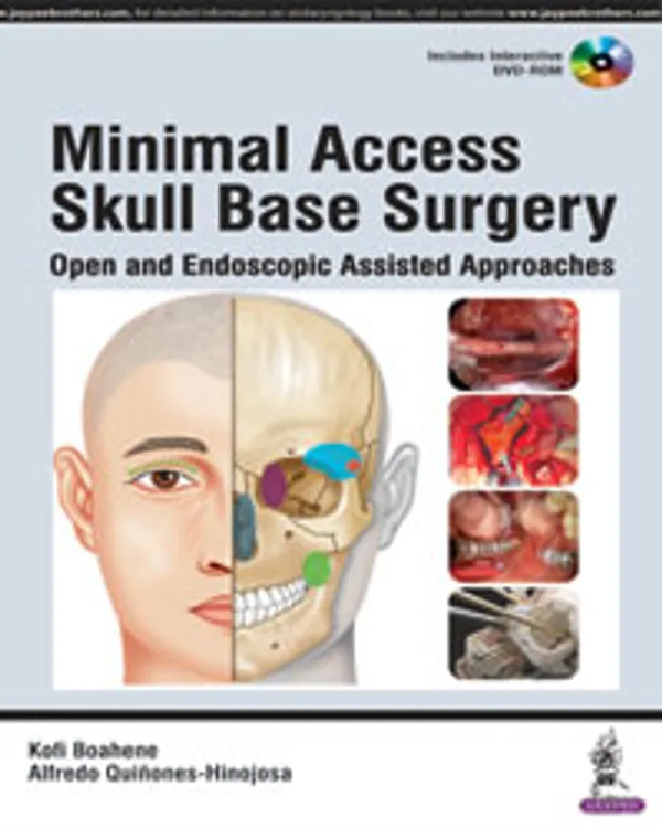 Minimal_Access_Skull_Base_Surgery_Open_And_Endoscopic_Assisted_Approaches_Includes_Interactive_Dvd_Rom