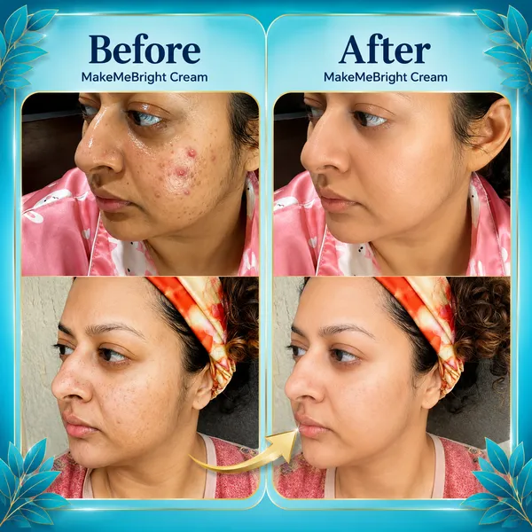Makemebright_Avocado_Whitening_Cream_Default_Title