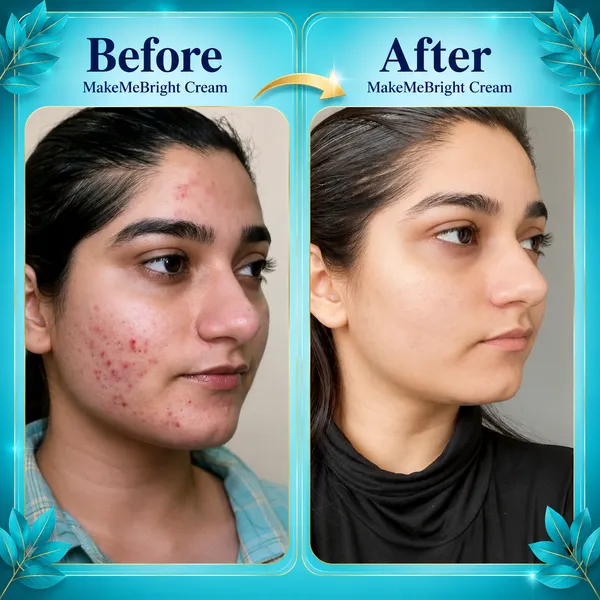 Makemebright_Avocado_Whitening_Cream_Default_Title