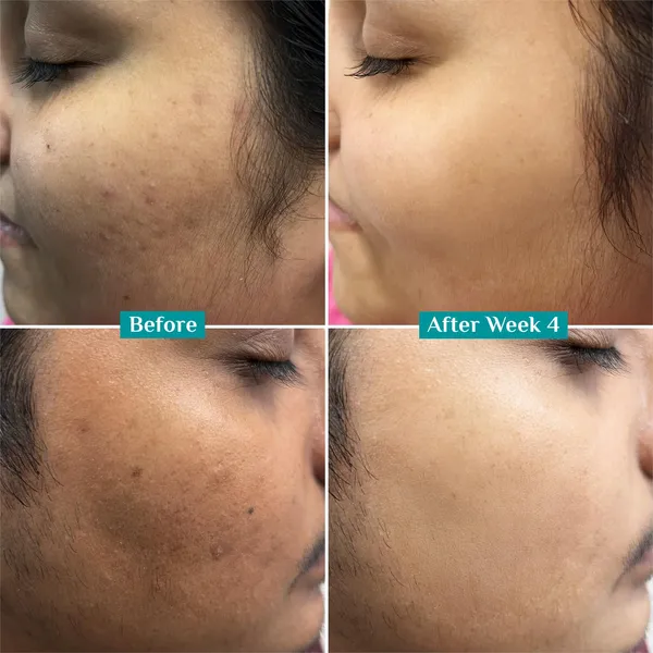 Ihc_Glow_10%_Vitamin_C_Niacinamide_Glutathione_Face_Serum
