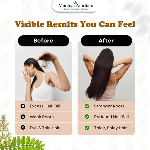 Kesh_Vaidhyam_Ayurvedic_Bhringraj_Almond_Hair_Oil
