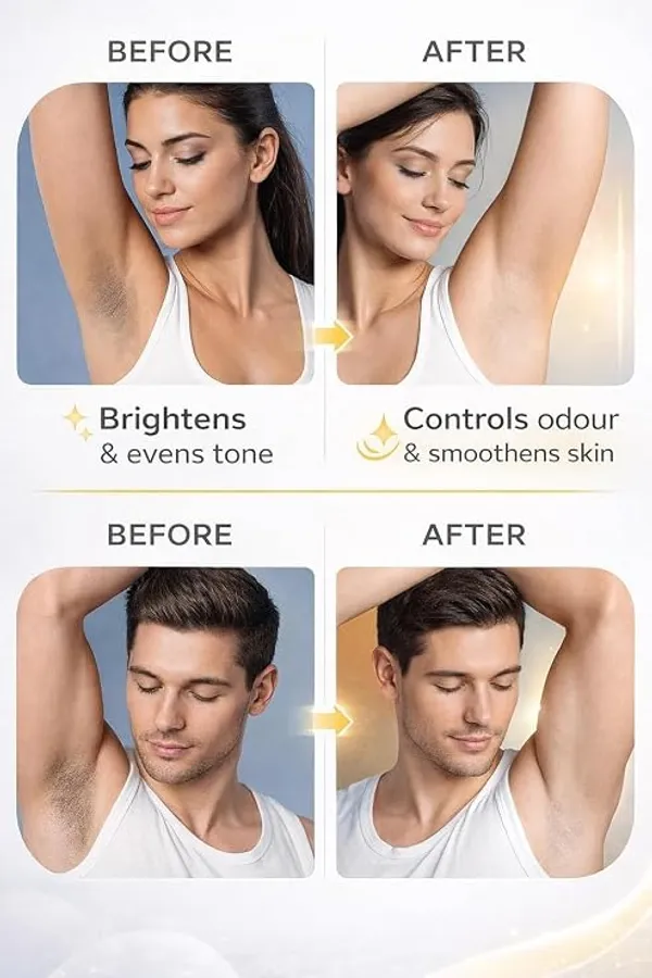 KALYRA_Daily_Underarm_Brightening_Roll_On_-_5%_Potassium_Azeloyl_Diglycinate_|_Helps_In_Reducing_&_Removing_Dark_Underarms_&_Body_Odour_for_Men_&_Women(50_ML)_(Pack_of_1)