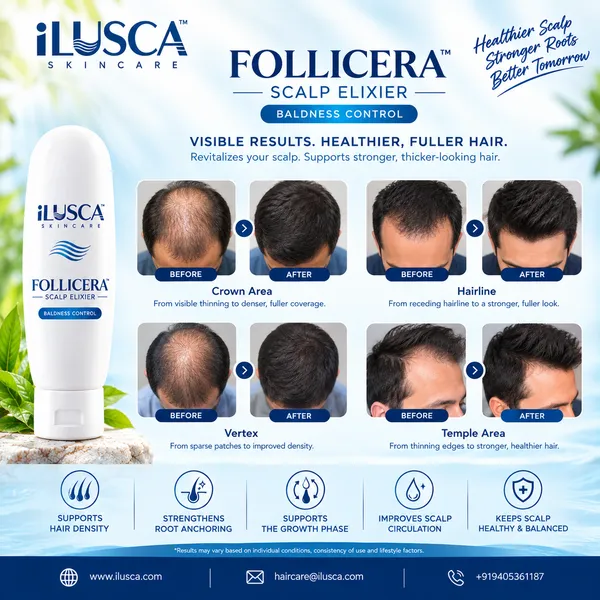 Baldness-control-elixir
