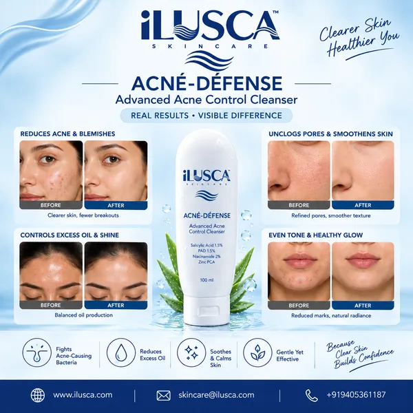Anti-acne-face-wash