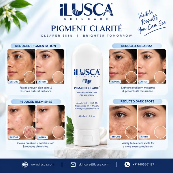 Anti-pigmentation-cream