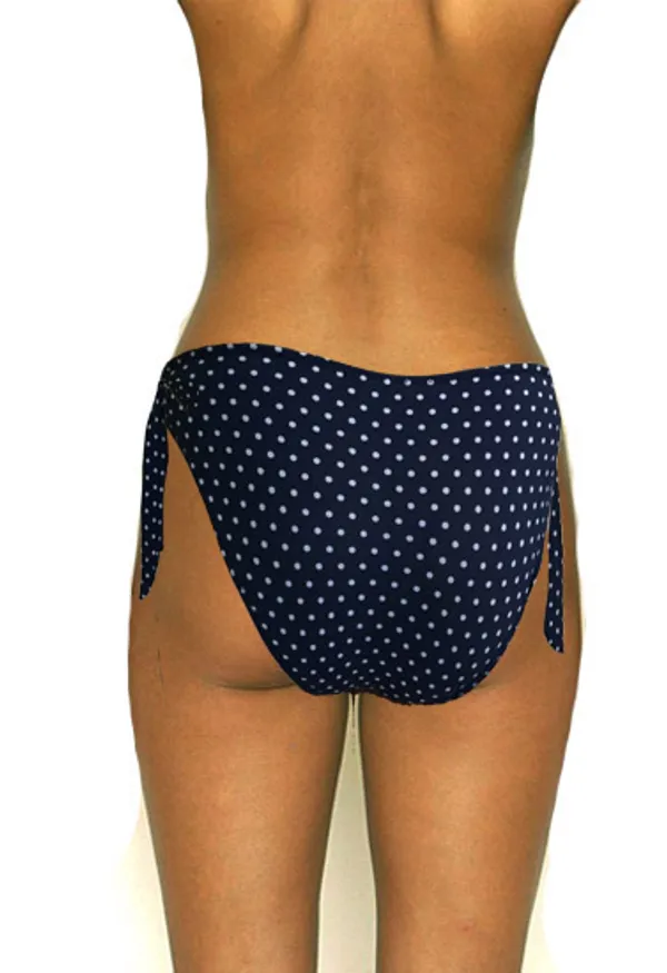 Luxelift_Beach_Beauty_Swim_Bra_For_Stunning_Silhouettes