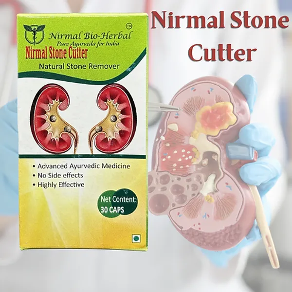 Nirmal_Stone_Cutter_capsules-_30_caps