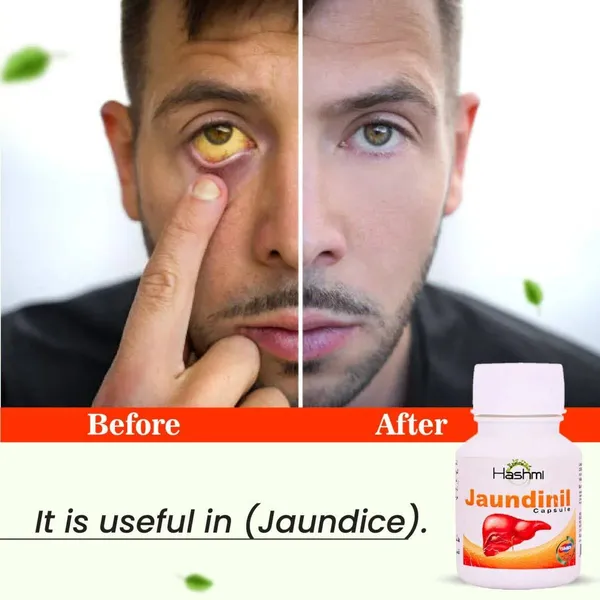 Hashmi_Jaundinil_20_Capsule_Default_Title