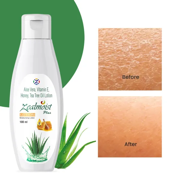 Zealmoist_Aloe_Vera_Glycerin_Deep_Hydration_Lotion_For_Dry_Sensitive_Skin_