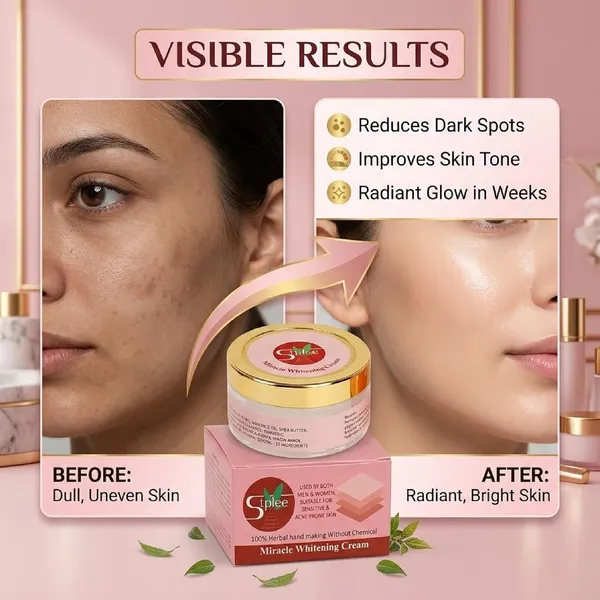 Natura_Niacinamide_Glutathione_Kojic_Acid_Alpha_Arbutin_Cream_Base_25G