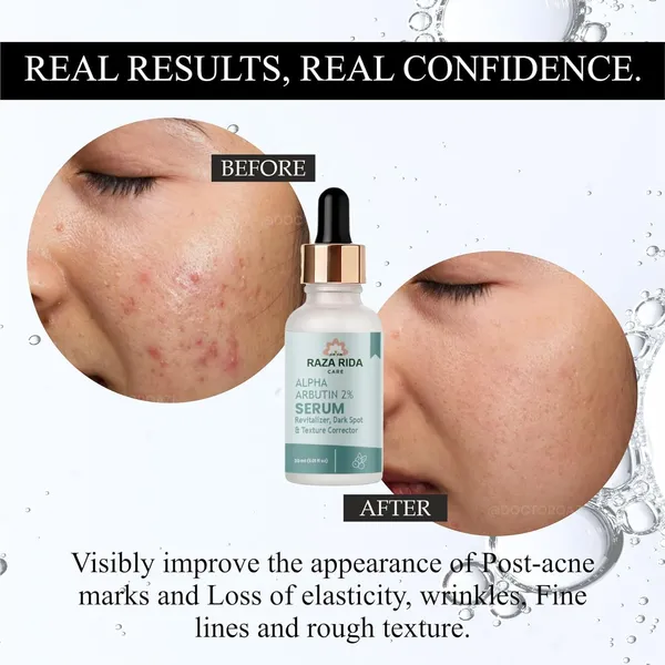 Alpha_Arbutin_Serum