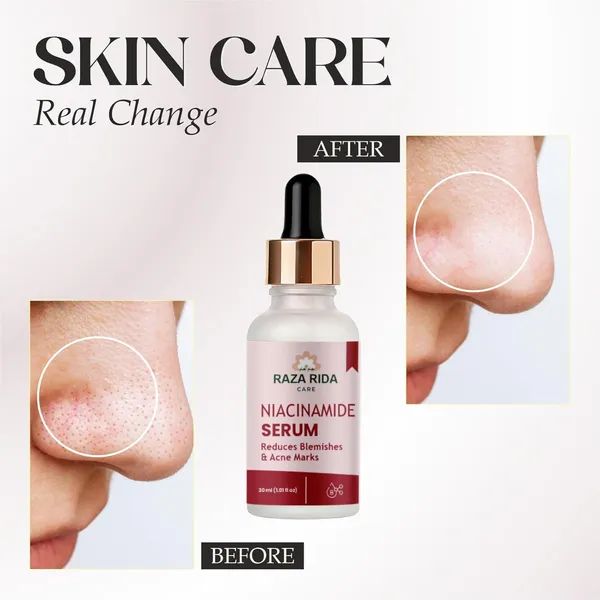 Niacinamide_Serum
