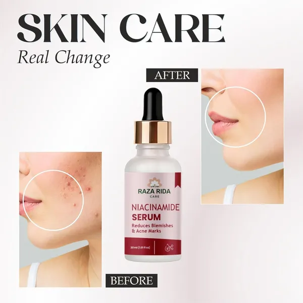 Niacinamide_Serum