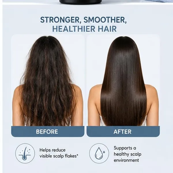 Anti_Dandruff_Hair_Conditioner