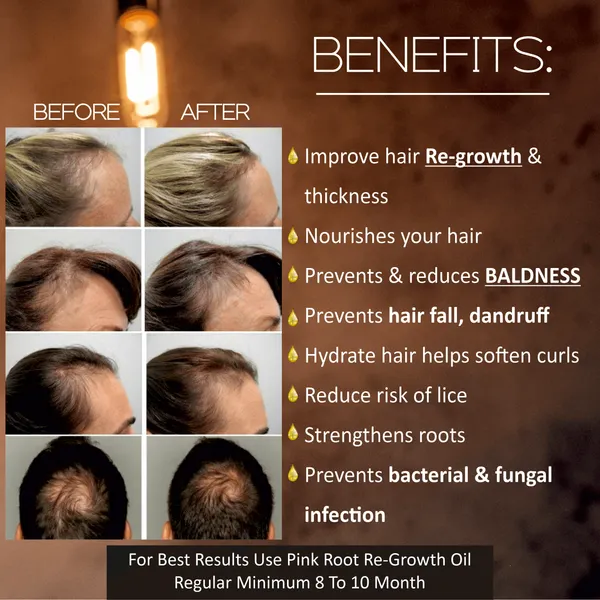 Pink_Root_Hair_Growth_Oil_Boosts_Follicles_Hair_Oil_With_Growth_Action_Guaranteed_Hair_Growth_By_Using_For_3_Months_Stimulates_The_Roots_Prevents_Baldness_100ml