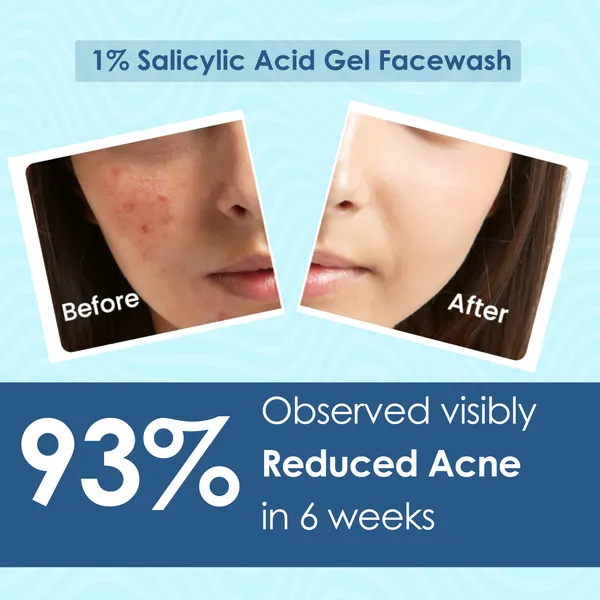1_Salicylic_Acid_Face_Wash_With_Kojic_Acid_100_Ml_Pink_Root_Reduces_Dark_Spots_Pigmentation_Blemishes_Cleanses_Brightens_Skin_Non_Drying_Formula