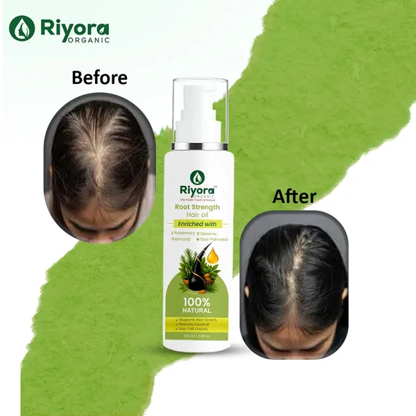Natural_Amla_Bhringraj_Onion_Extract_Neem_Hair_Oil_With_Comb_Pack_Of_2