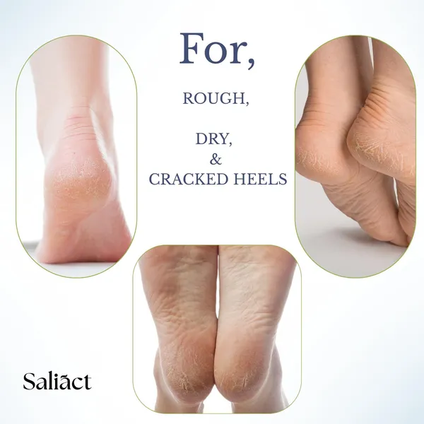 Urea_Foot_Cream_Roll_On