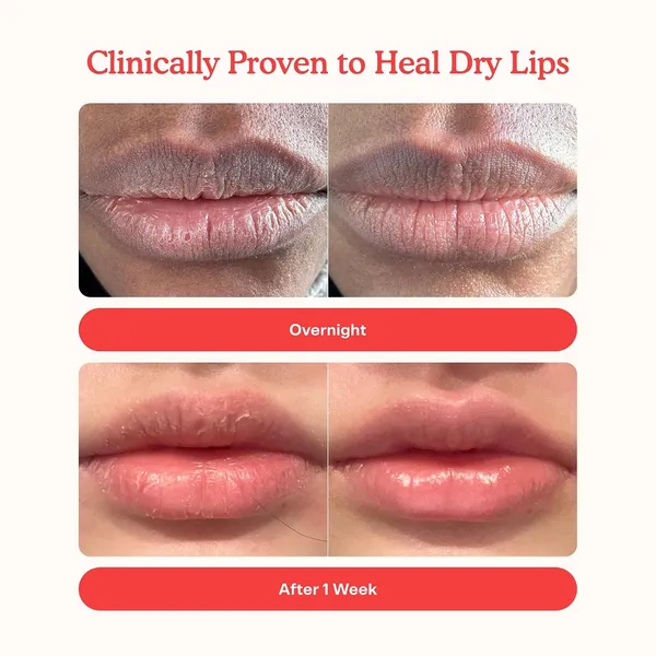 Flavoured_Lip_Balm_For_Dry_Lips
