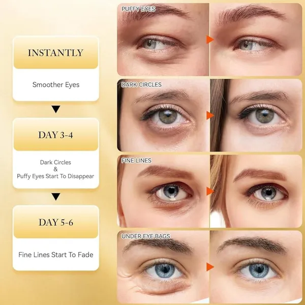 Gold_Hydrogel_Under_Eye_Patches