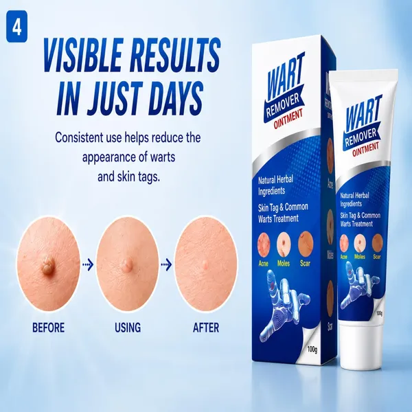 Wart_Remover_Ointment