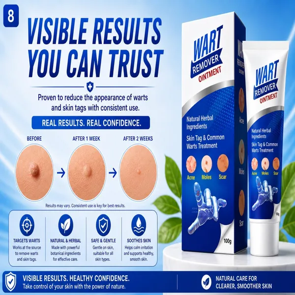Wart_Remover_Ointment