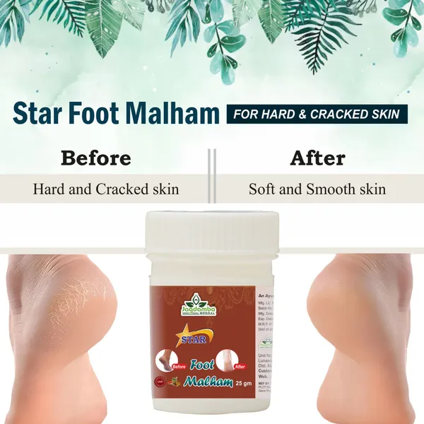 Star_Foot_Malham_Ayurvedic_Relief_For_Cracked_Heels_And_Foot_Pain_Pack_Of_3_75_Gm_-_Pack_of_2
