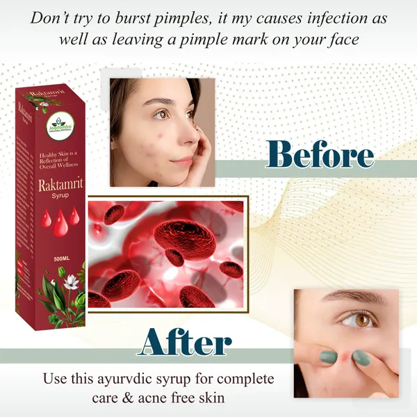 Raktamrit_Syrup_Ayurvedic_Herbal_Blood_Purifier_Syrup_For_Daily_Wellness_Skin_Health_Jagdamba_Herbal