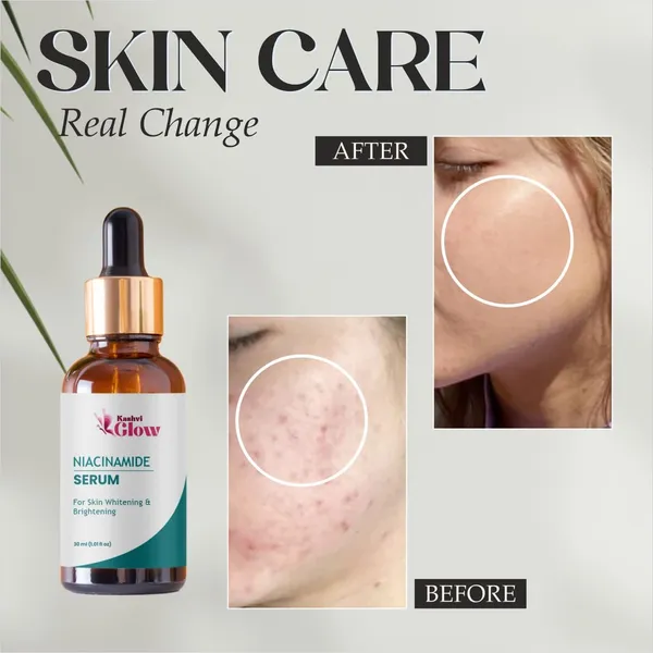 Niacinamide_Serum