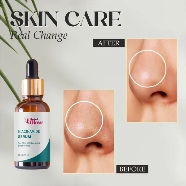 Niacinamide_Serum