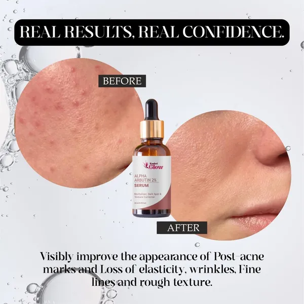 Alpha_Arbutin_Serum