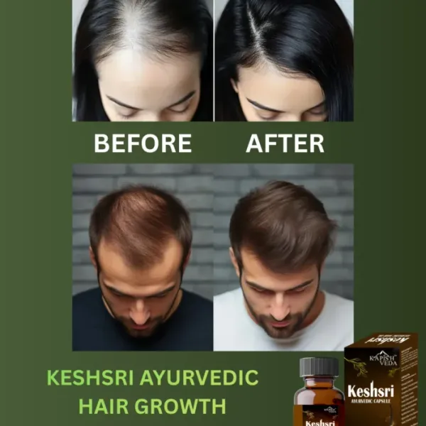 Keshsri_Capsule
