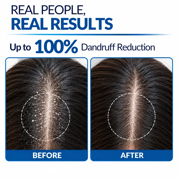 Ziba_Glowup_Anti-Dandruff_Shampoo_With_Hydroxypropyl_Polyquaternium