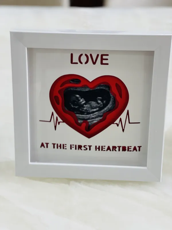 3d_Ultrasound_Photo_Frame