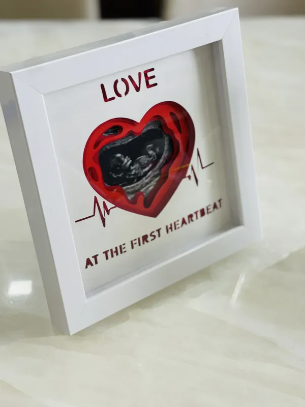 3d_Ultrasound_Photo_Frame