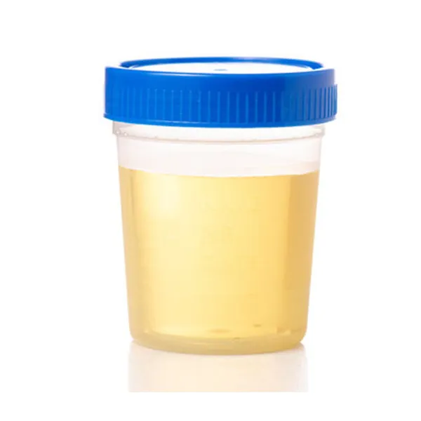 Urine_Culture_Bottle_Plastic_Pack_Of_100