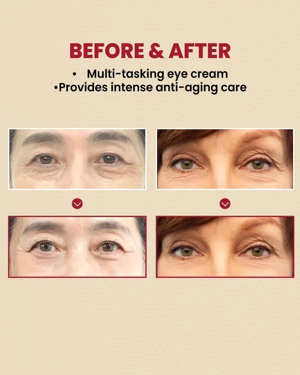 Hydrating_Eye_Cream_For_Dark_Circles_And_Puffiness