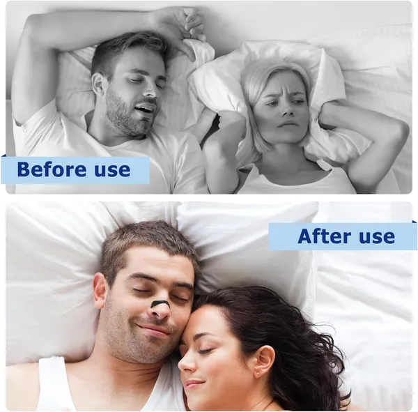 Skin-Friendly_Adhesive_Nasal_Strips_For_Easy_Airflow
