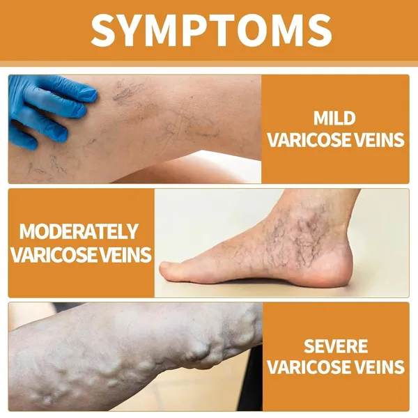 Adhesive_Leg_Care_Patch_Pack_Of_5
