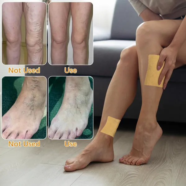 Adhesive_Leg_Care_Patch_Pack_Of_5