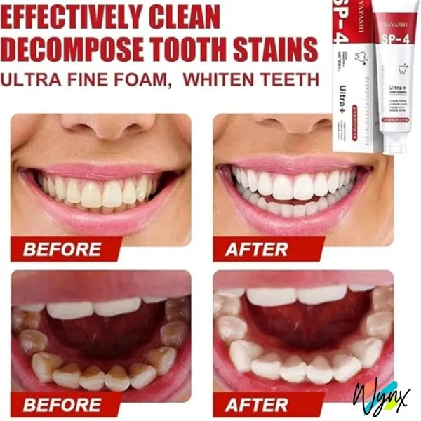 Multi-Benefit_Teeth_Whitening_Oral_Care_Treatment