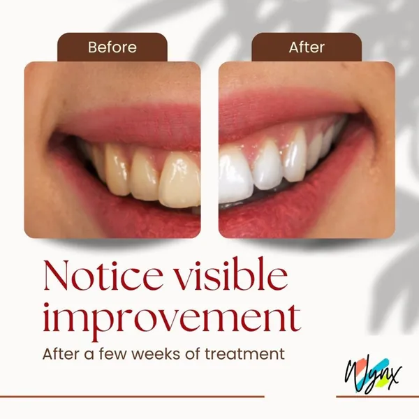 Multi-Benefit_Teeth_Whitening_Oral_Care_Treatment