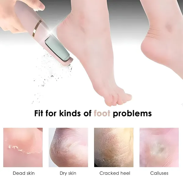 Rechargeable_Electric_Foot_Callus_Remover