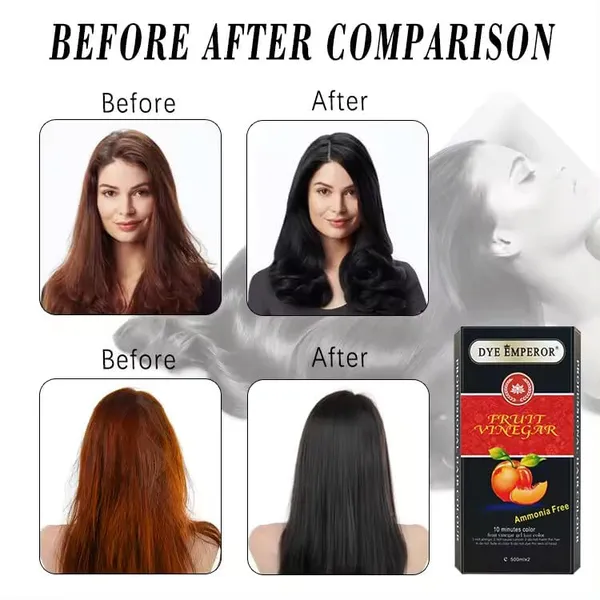Dye_Emperor_Fruit_Vinegar_Gel_Hair_Color_Dye,_Organic_Natural_Black_Color_Dye_for_Men_and_Women_Both_Long_Lasting_Coloring_-1000_ml